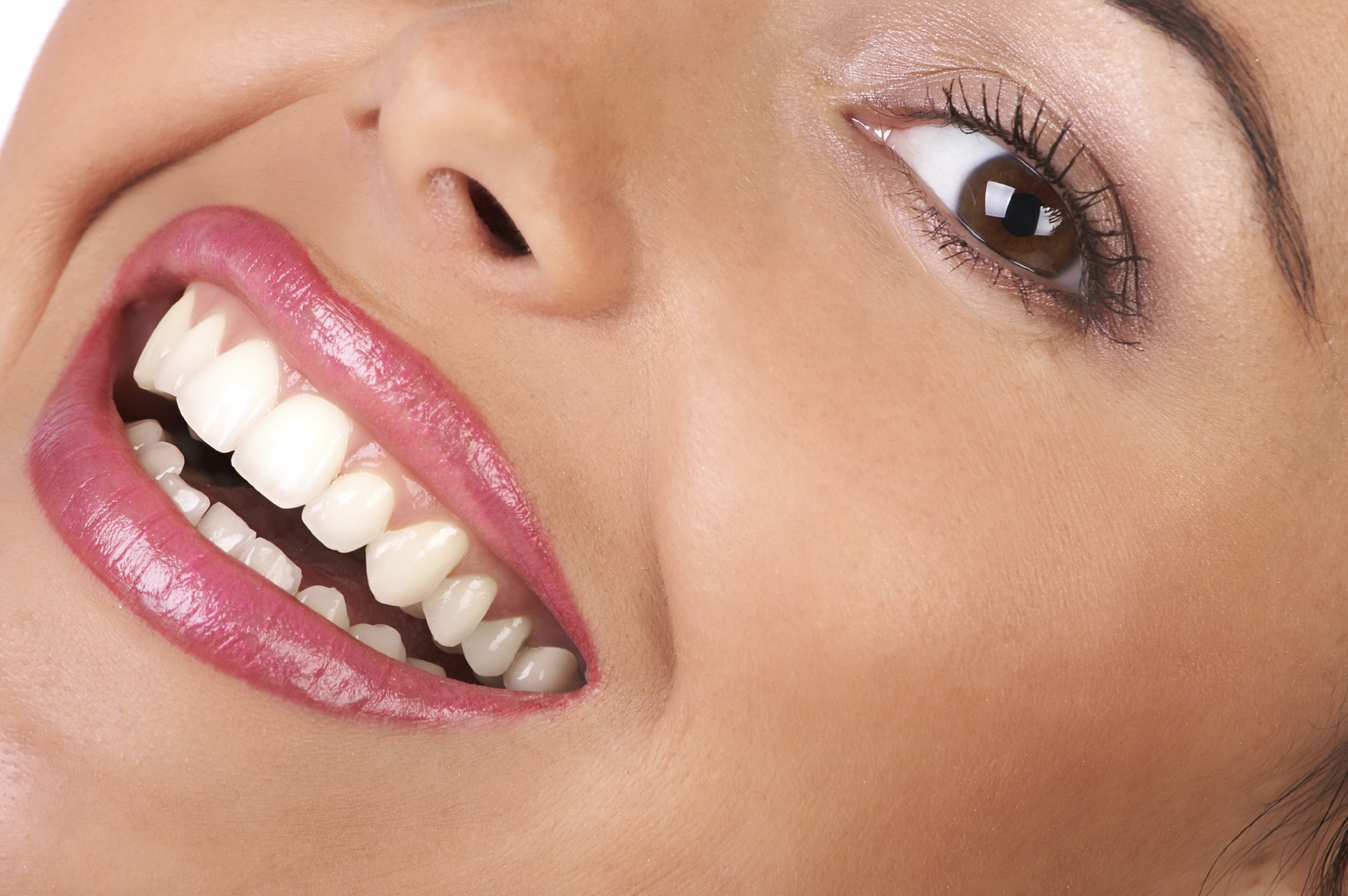 Teeth whitening Newport